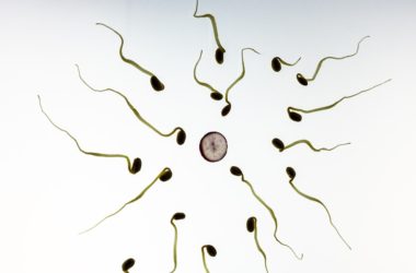 Barva spermií: co může znamenat?